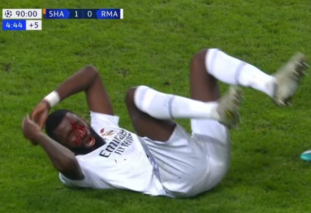 1665522634334086090.png rm1.png